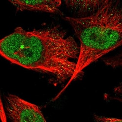 ZNF566 Antibody, Novus Biologicals:Antibodies:Primary Antibodies